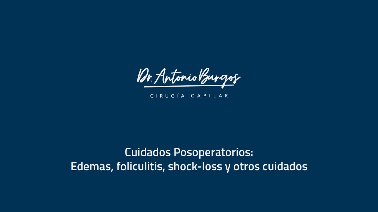 Cuidados posoperatorios: edemas, foliculitis, shock loss... | INJERTO CAPILAR