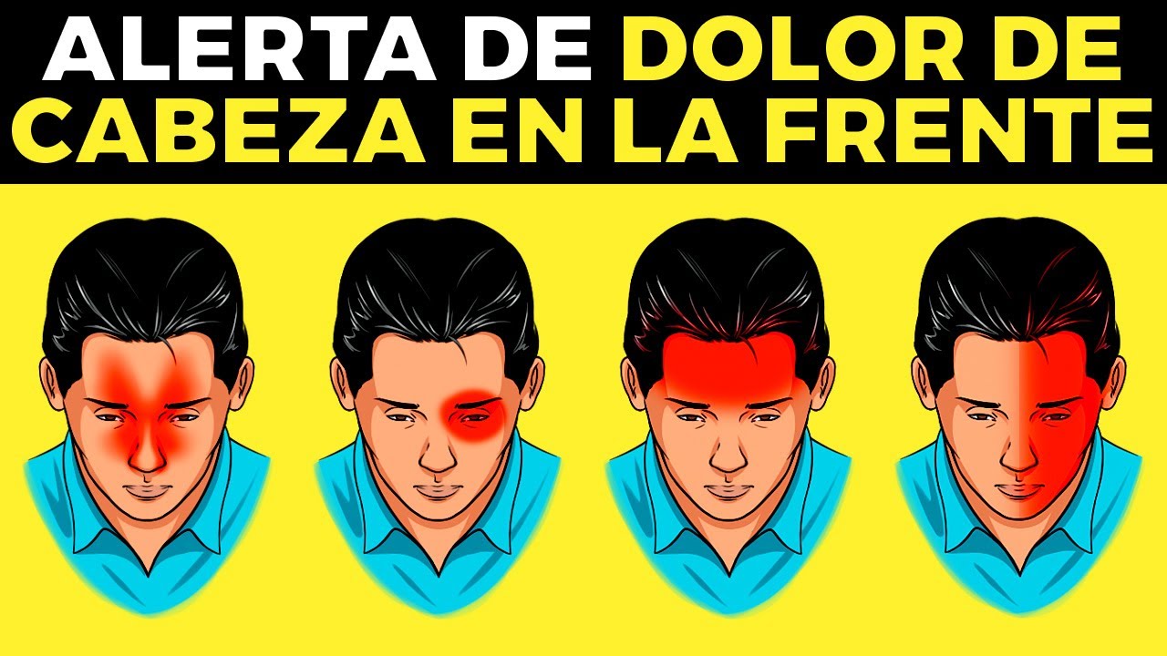 4 razones por las que tienes DOLOR DE CABEZA EN LA FRENTE y soluciones
