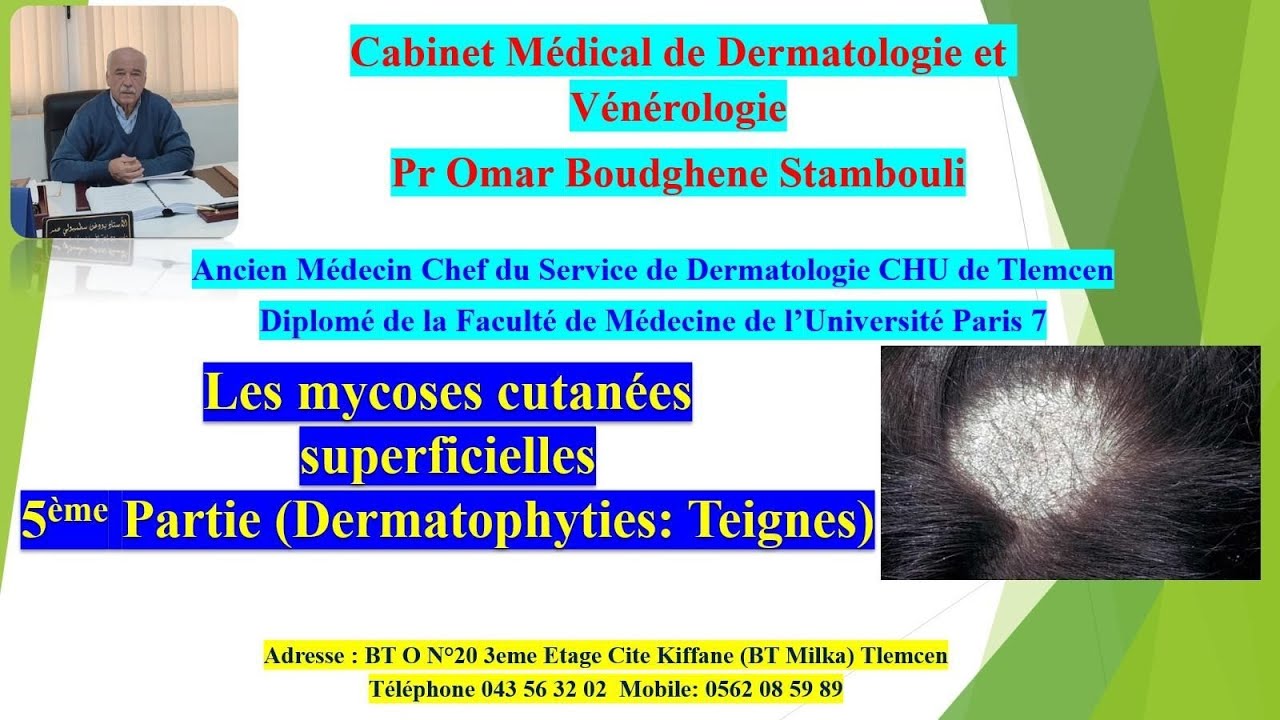 Les mycoses cutanées superficielles 5ème Partie (Dermatophyties: Teignes)