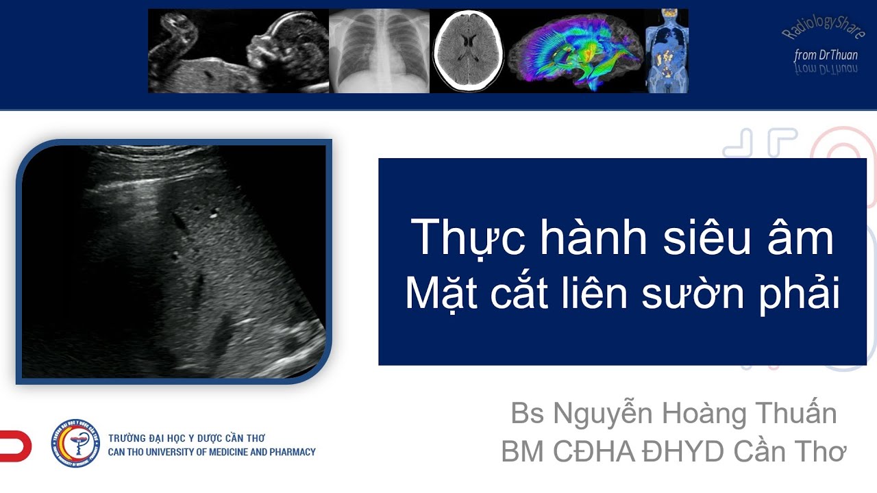Hướng dẫn thực hành MCCB -2021- MC liên sườn phải