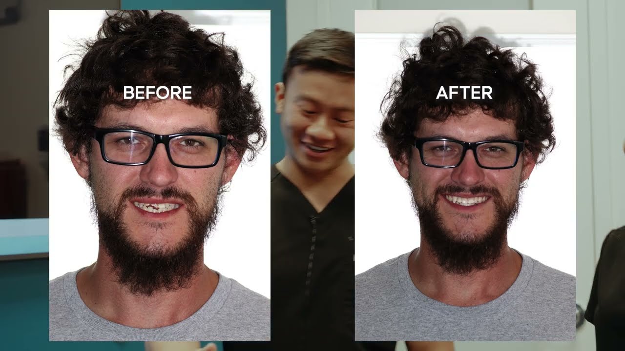 Groom’s Wedding-Ready Smile Glow-Up in Just 45 Minutes 😍✨
