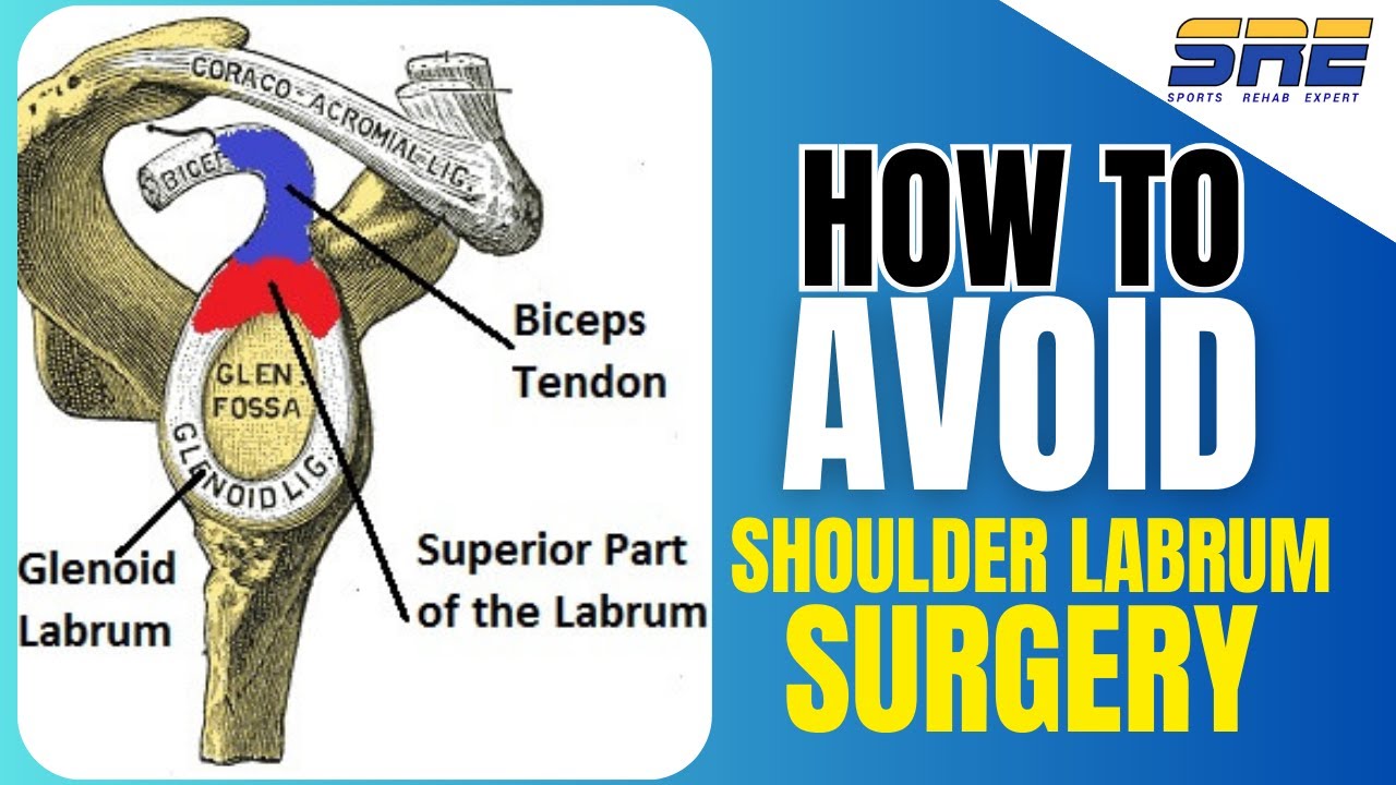 Shoulder Labrum Rehab Exercise Plan