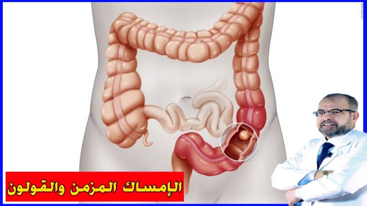 تخلص من الإمساك المزمن ونظف القولون بهذه الأشياء الطبيعية | دكتور جودة محمد عواد
