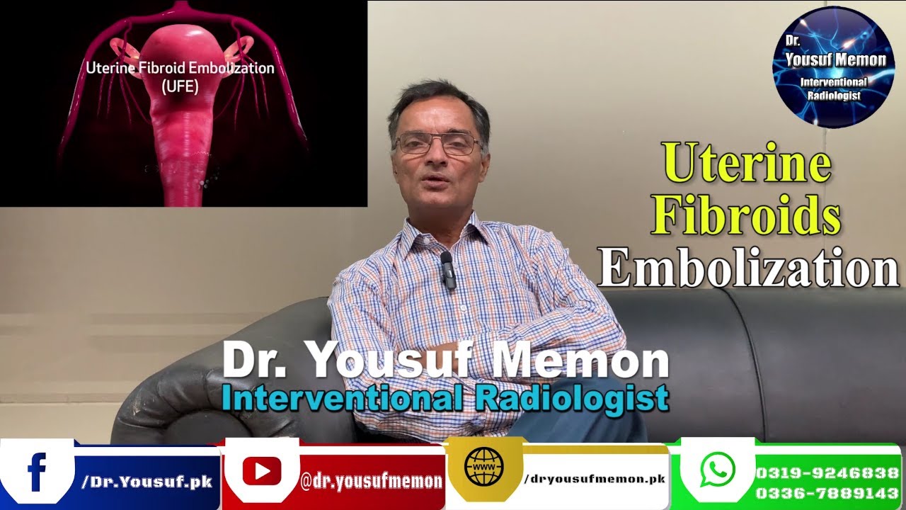UTERUS FIBROIDS EMBOLIZATION IN PAKISTAN  | No need to remove uterus.