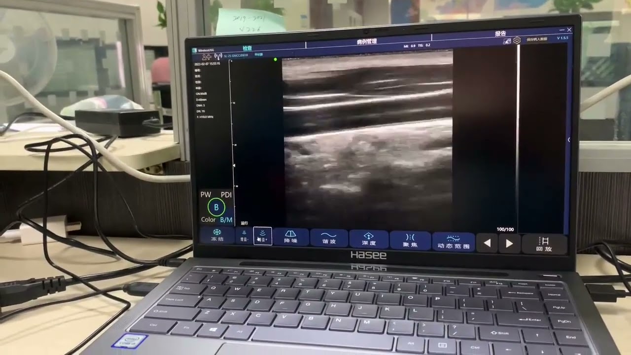 handheld ultrasound connect.with PC, support iOS, Android, Windows #ultrasound 