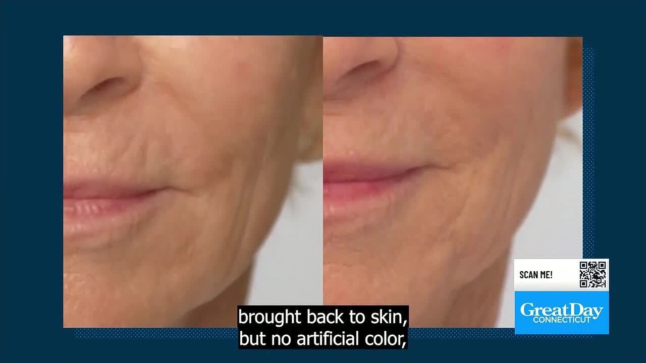 Ice Elements Skin Care