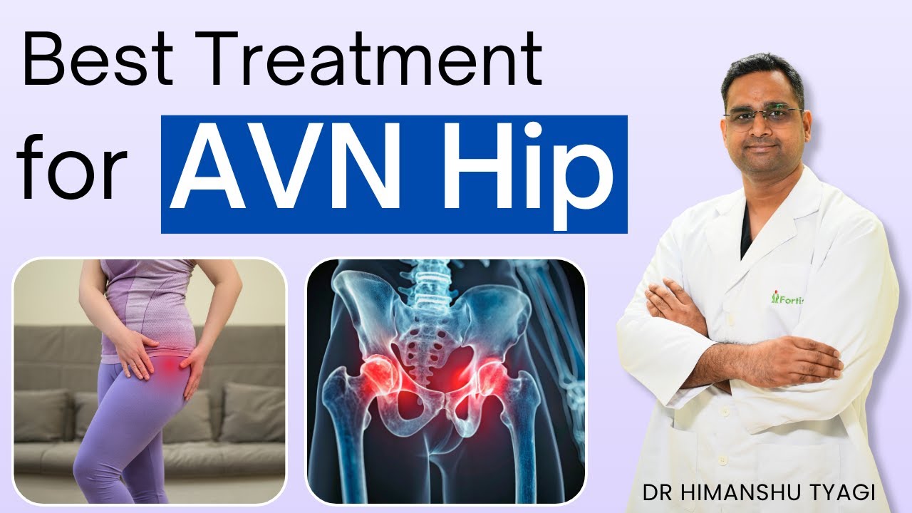 Best Treatment for AVN Hip | Avascular Necrosis Stages & Hip Replacement Explained