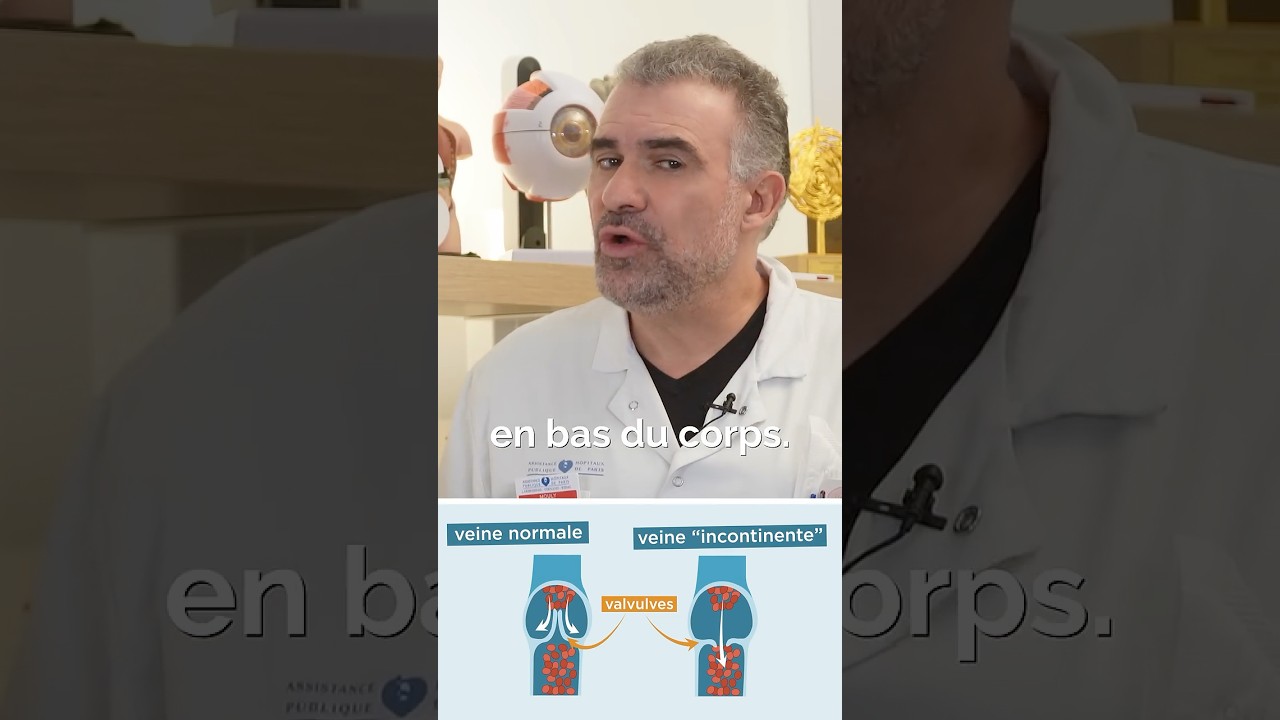 Varice ou phl&eacute;bite ? Ne confondez plus ! On vous explique la v&eacute;rit&eacute; sur ces maladies veineuses.