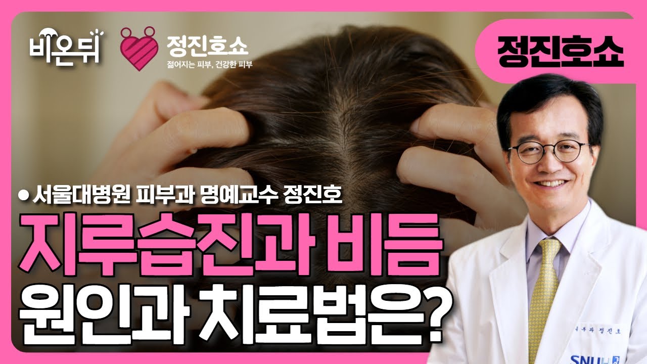[정진호쇼, 젊어지는 피부 건강한 피부] 지루습진과 비듬의 원인과 치료 / 서울대병원 피부과 정진호