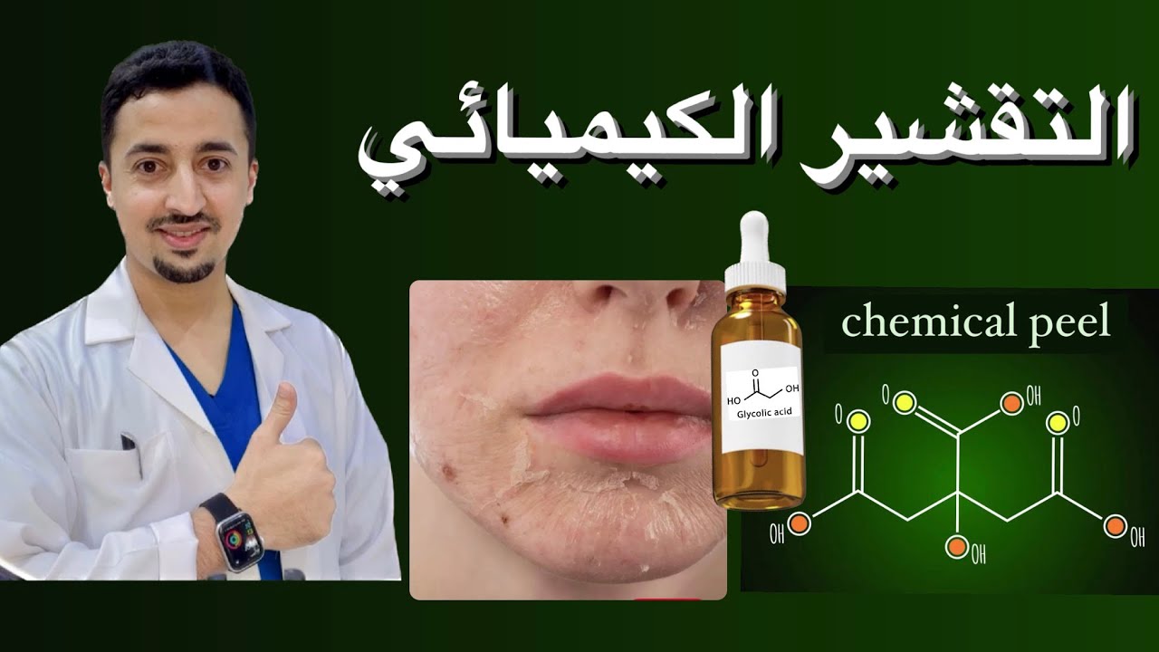 التقشير الكيميائي