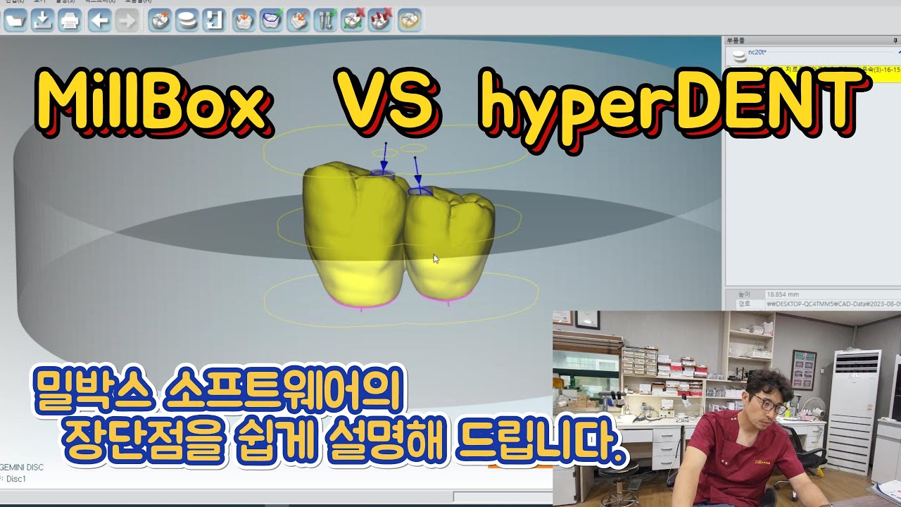 millbox와 hyperdent을 비교하며 장단점을 공유해보고자합니다.
