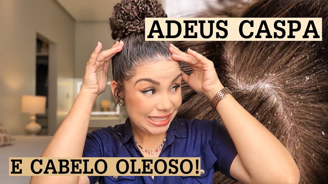 Dicas para combater a caspa e oleosidade dos cachos!