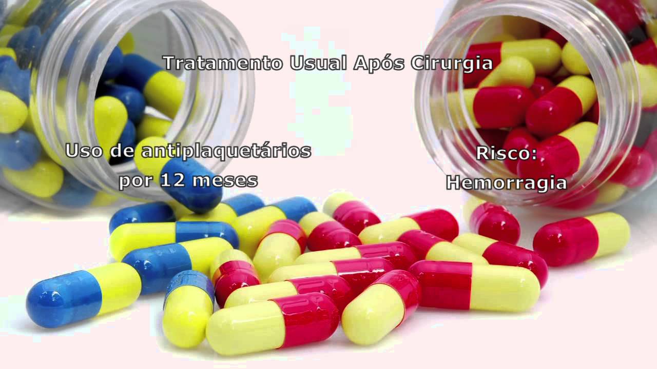 Pesquisa indica redução de uso de antiplaquetários em angioplastia