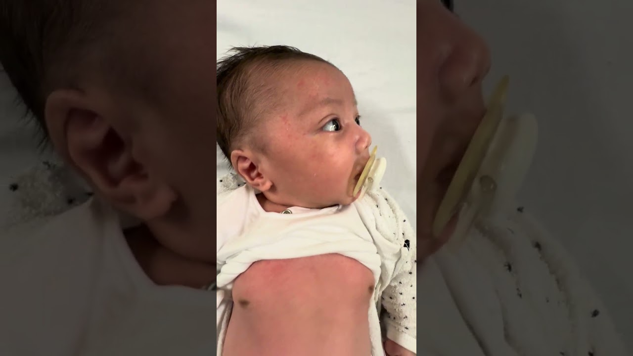 Infant with Bronchiolitis