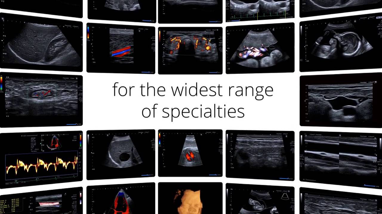 Xario 200 Ultrasound – Powerful and Compact