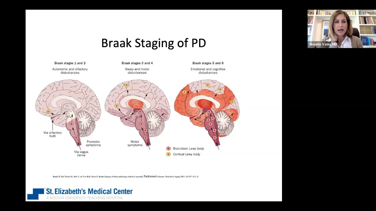 Sleep Matters: A Review of Sleep Issues in Parkinson's with Dr. Okeanis Vaou