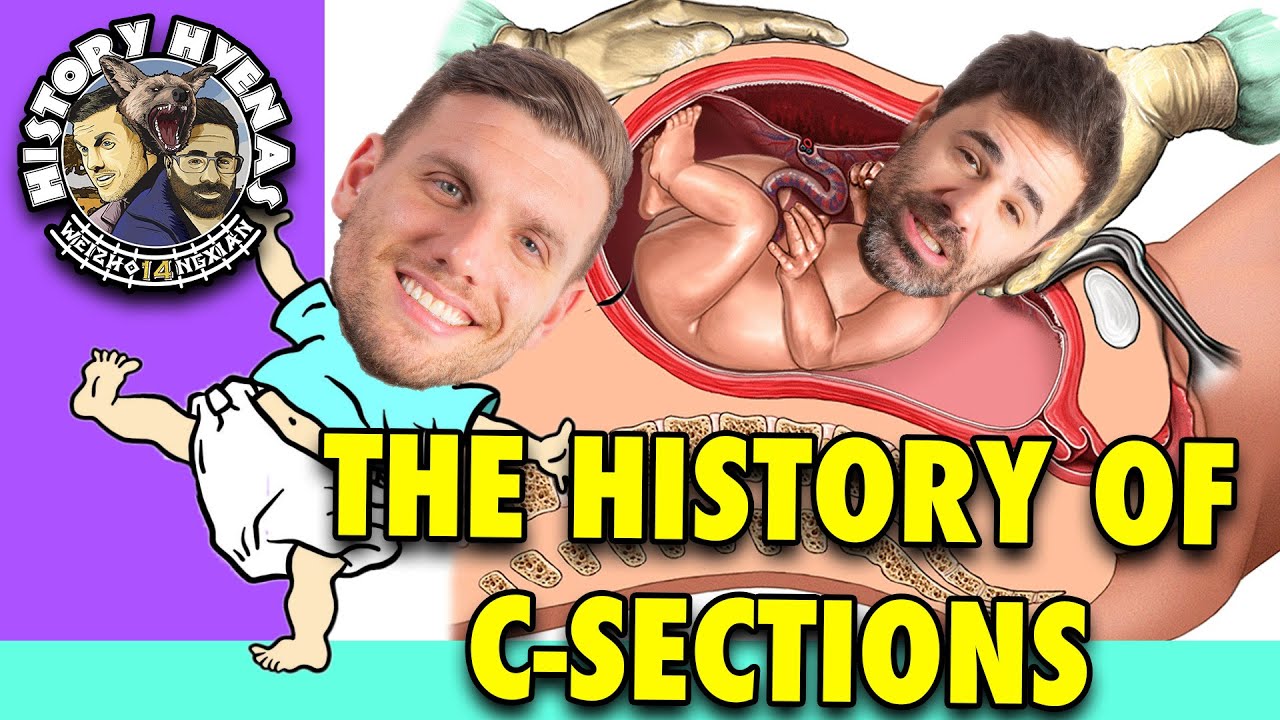 C-Sections are WILD! | ep 160 - History Hyenas