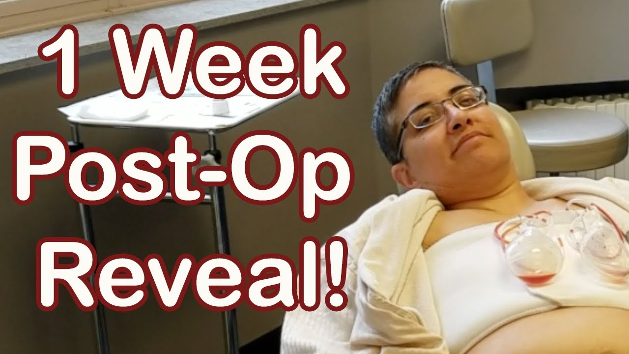 FTM Trans: 1-Week Post Top Surgery Reveal w/ Dr. Mosser