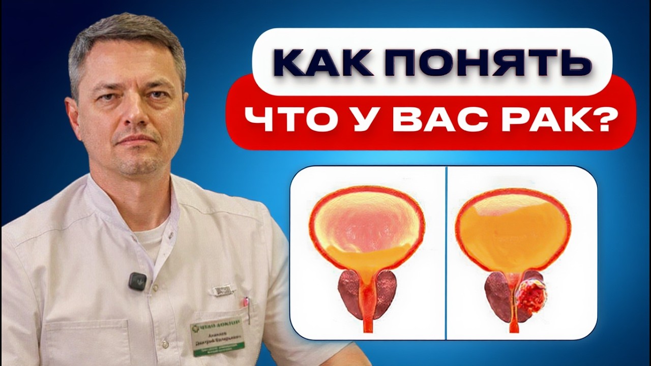 5 симптомов, которые говорят об онкологии простаты на ранней стадии: