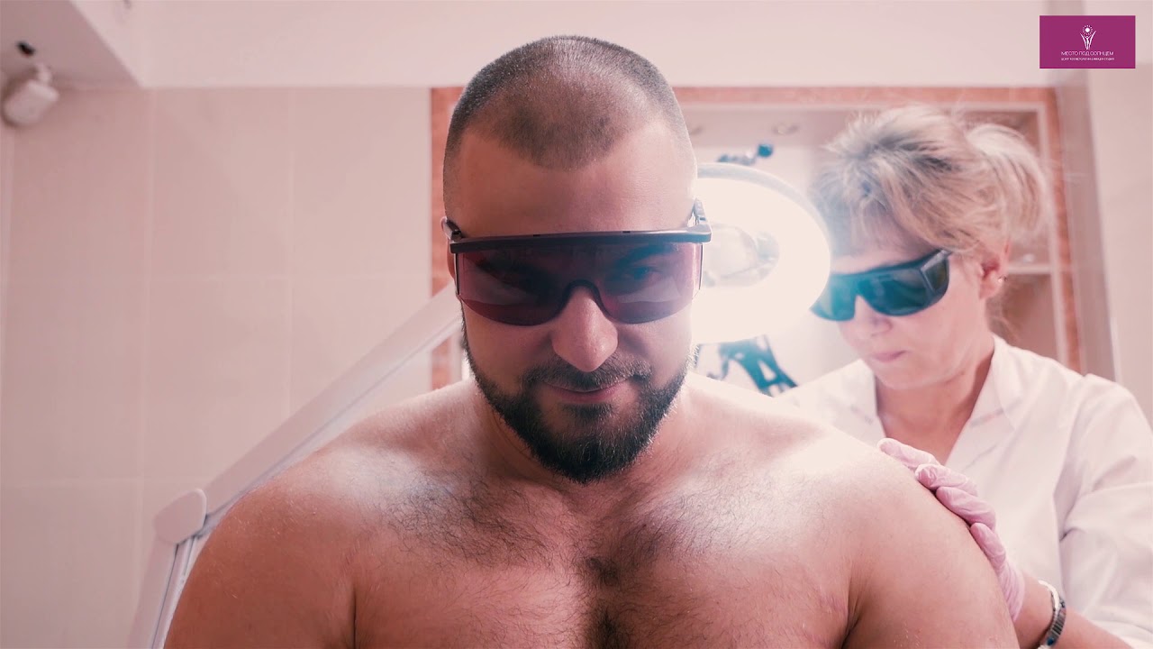 Лазерная эпиляция для мужчин