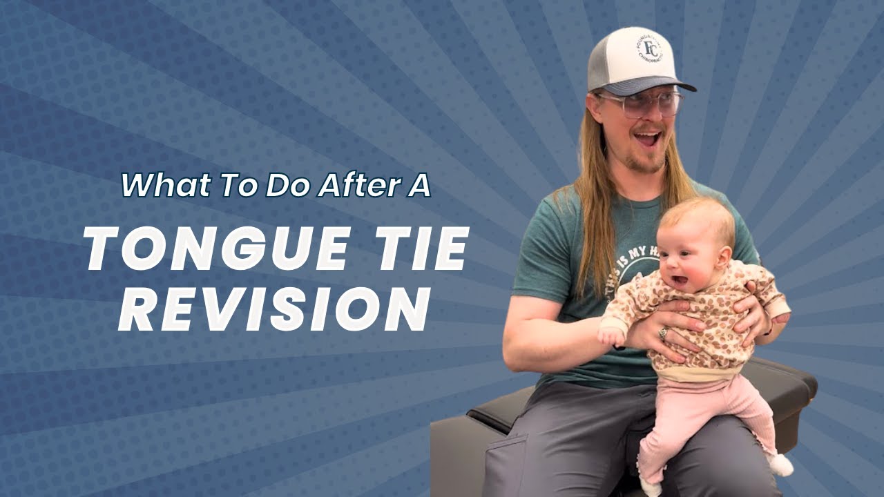 What To Do After A Tongue Tie Revision