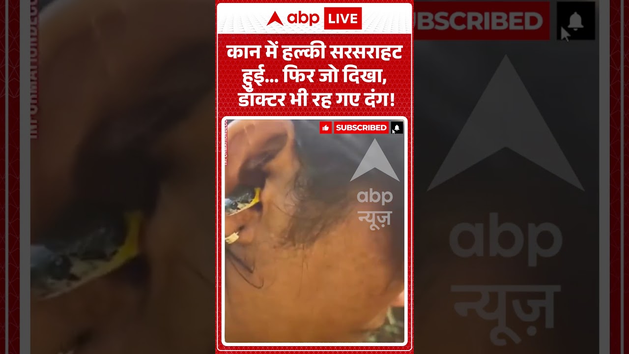 Viral Video : कान में हल्की सरसराहट हुई फिर जो दिखा, डॉक्टर भी रह गए दंग ! | #viral #ytshorts #snake