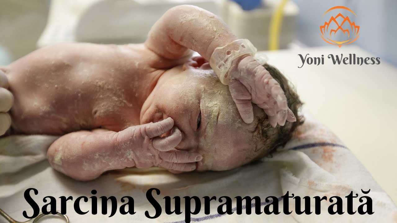 S1.Ep65: Sarcina supramaturată | Sarcina după termen | Sarcina prelungită | Risc de moarte fetală !