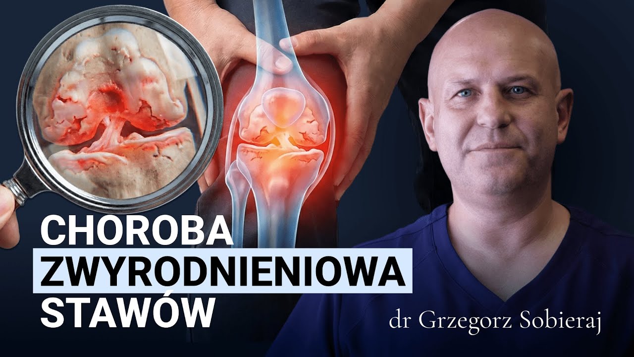 CHOROBA ZWYRODNIENIOWA STAWÓW I ENDOPROTEZOPLASTYKA – o bólu, sprawności i powrocie do zdrowia