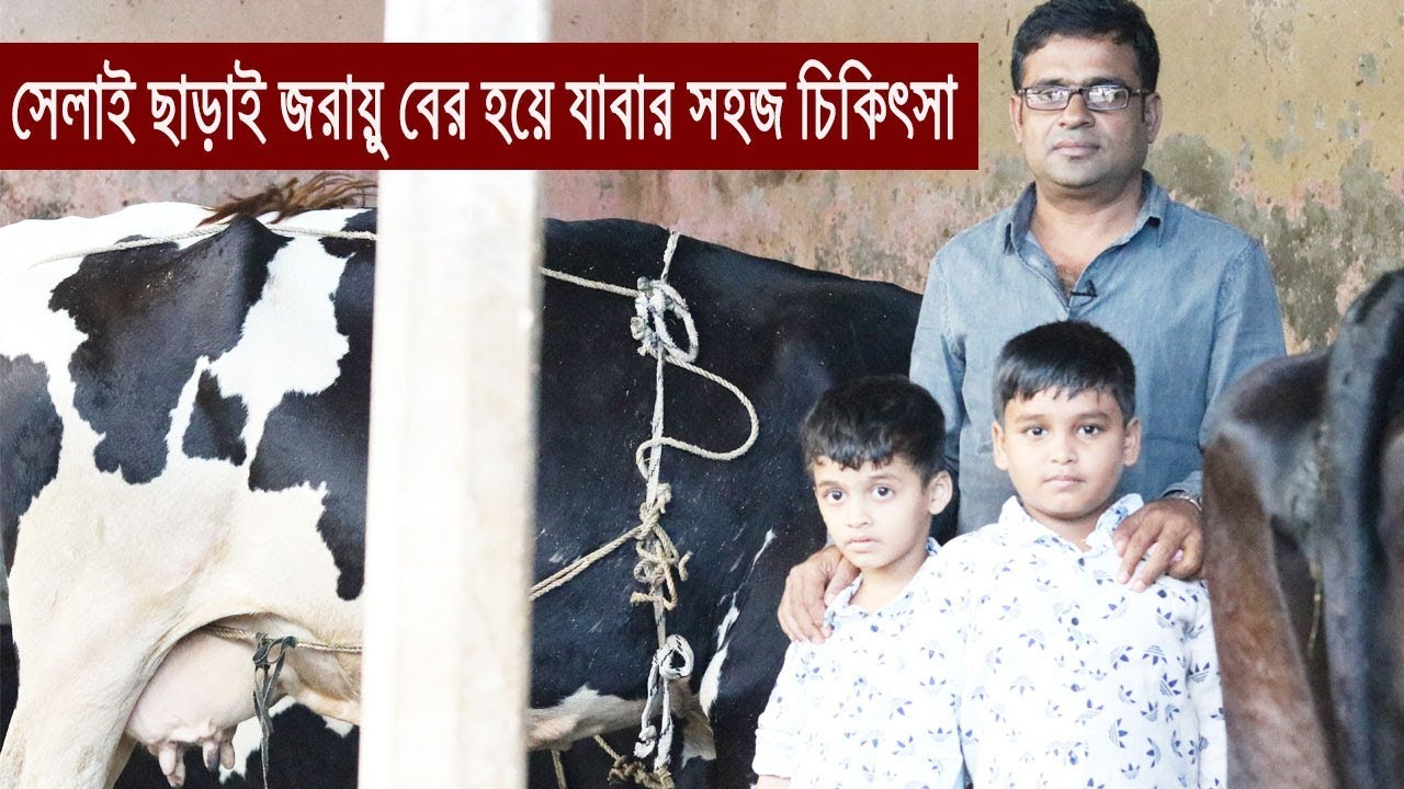 জরায়ু বের হয়ে গেলে কি করবেন? সেলাই না এটাকে বলে দরি চিকিৎসা।
