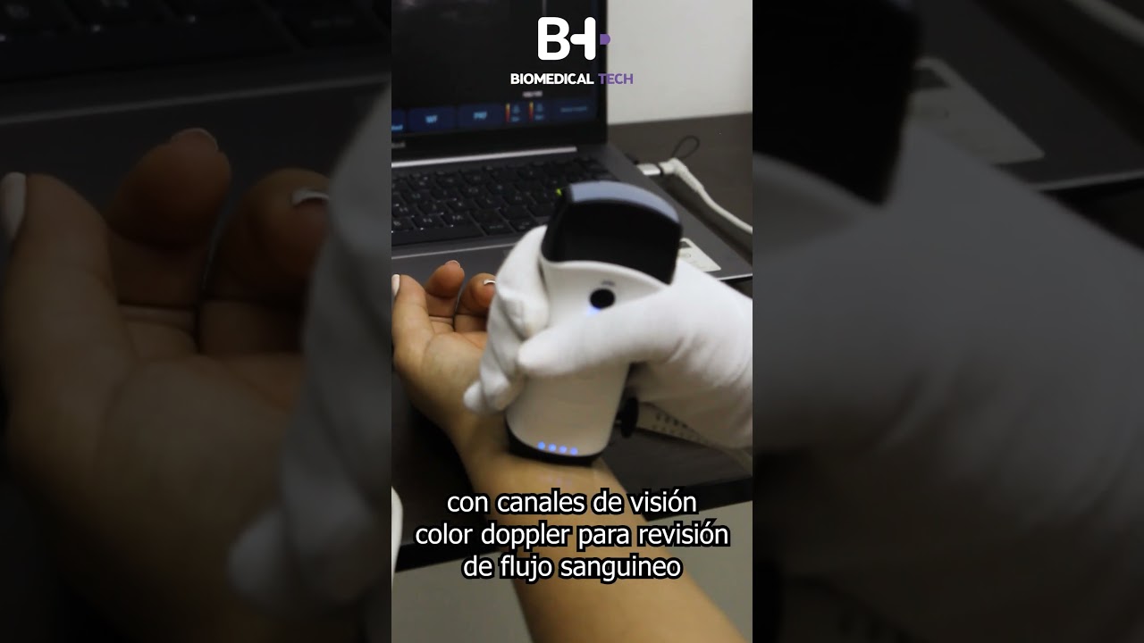 Todo lo que tiene un ecógrafo en un equipo portátil - SONDA KONTED C10RL