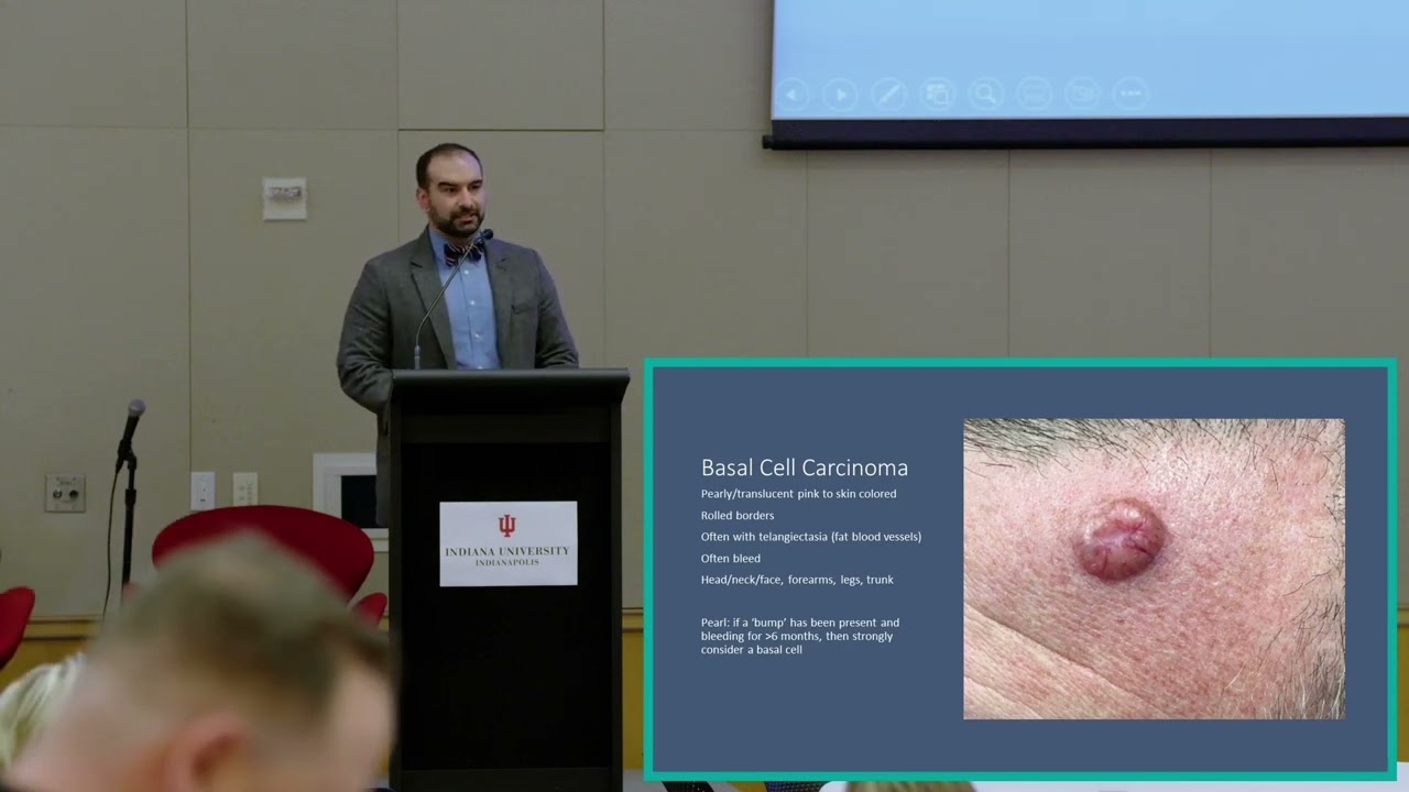 Skin Findings in Autoimmune Patients