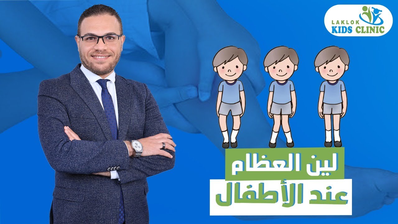 لين العظام عند الاطفال .. الوقاية | تغذية 100 100