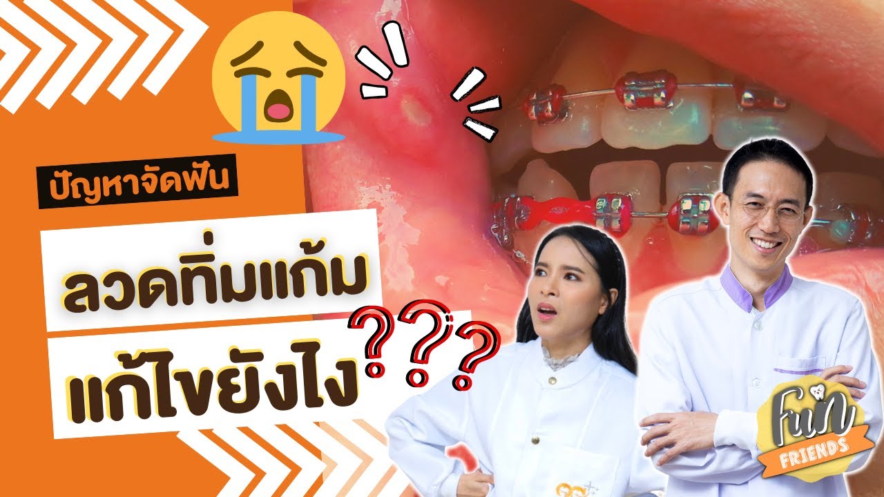ลวดทิ่มแก้ม ลวดงอ เหล็กจัดฟันตำเหงือก แก้ไขยังไง? |จัดฟันที่แท้ FunFriends เพื่อนกันฟันดี|