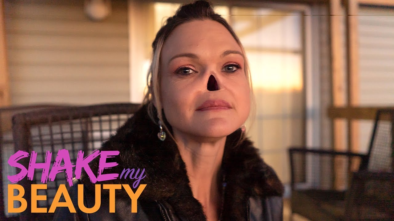 I Lost My Nose To Cancer | SHAKE MY BEAUTY