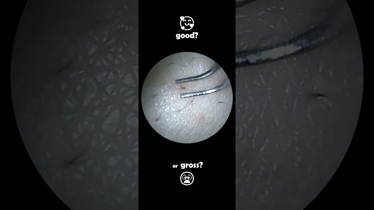 Good or Gross? satisfying ASMR