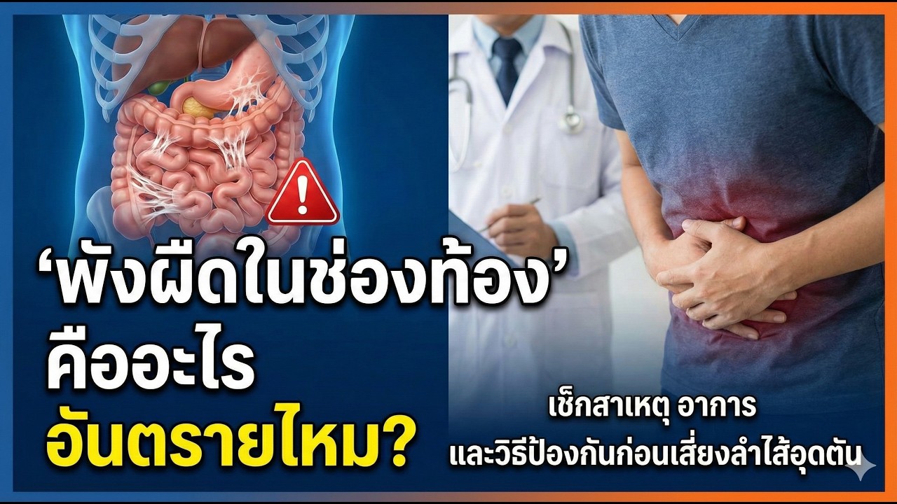 'พังผืดในช่องท้อง' คืออะไร อันตรายไหม เช็กสาเหตุ อาการ และวิธีป้องกันก่อนเสี่ยงลำไส้อุดตัน