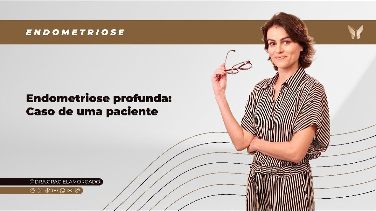 ENDOMETRIOSE PROFUNDA: CASO DE UMA PACIENTE