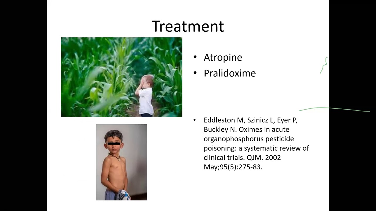 Approach to a child with toxin ingestion