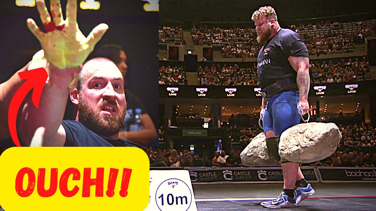 OUCH! Hands MANGLED in NICOL STONES World Record