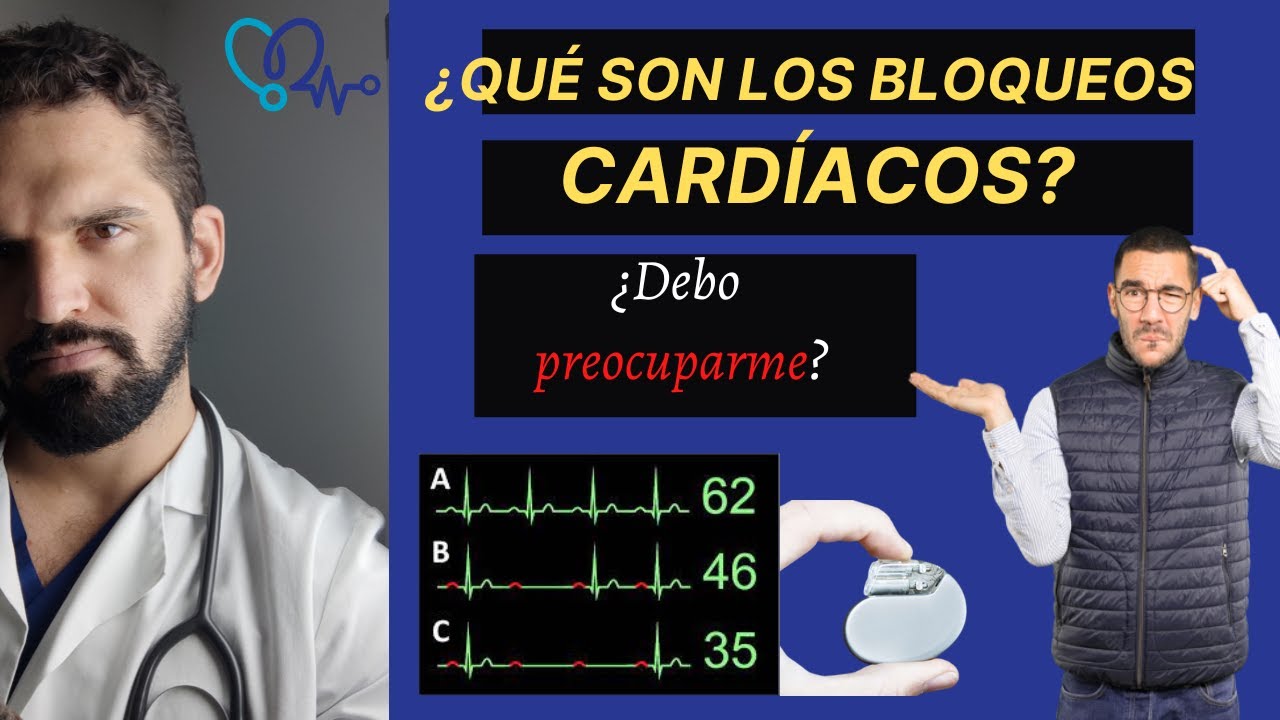 ¿BLOQUEOS cardíacos? 🛑😳 A.V y de ramas. ¿Es de peligroso?  ⚠. Aquí te explico SUPER sencillo ✅