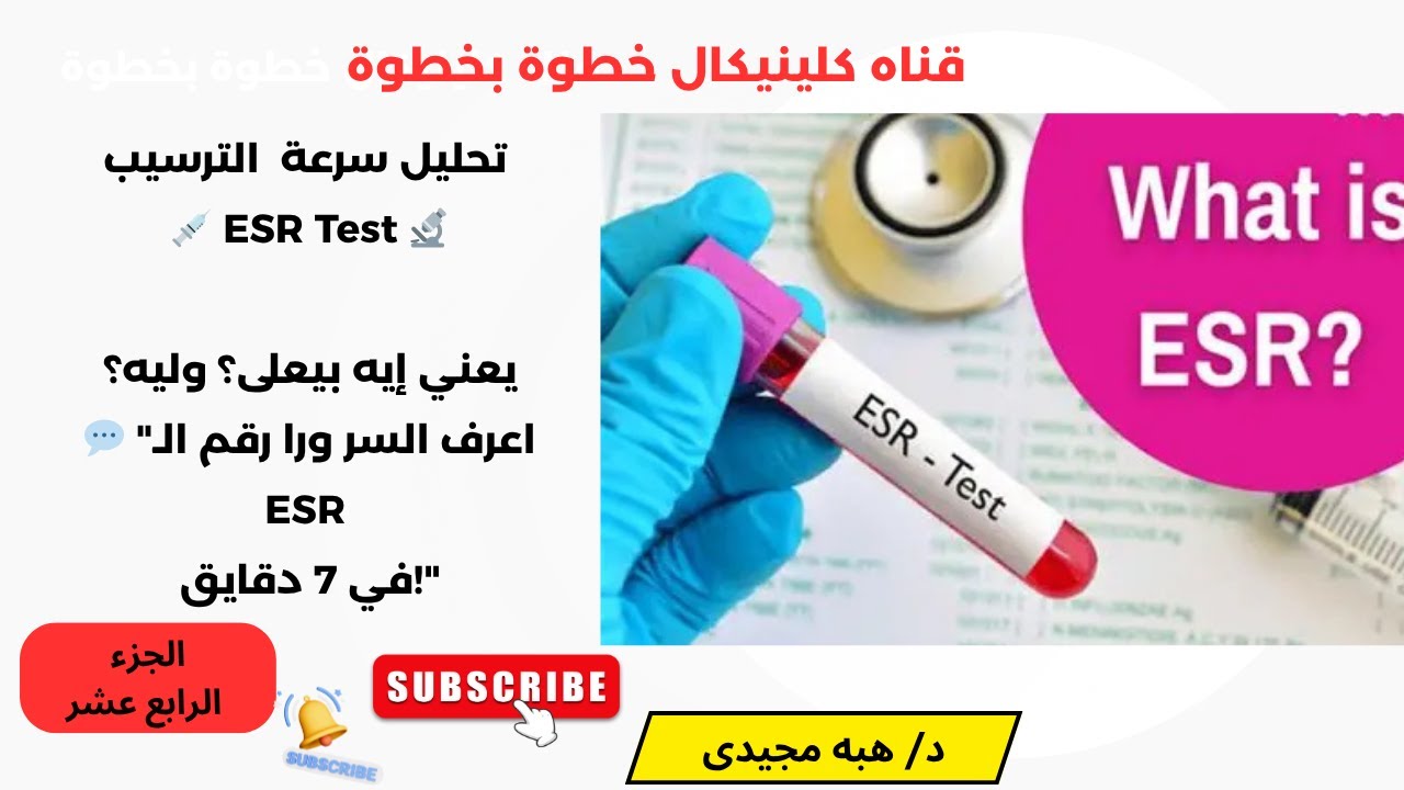 🔬 ESR Test Explained  الجزء 14 تحليل سرعه ترسيب الدم إمتى يعلى وليه ؟