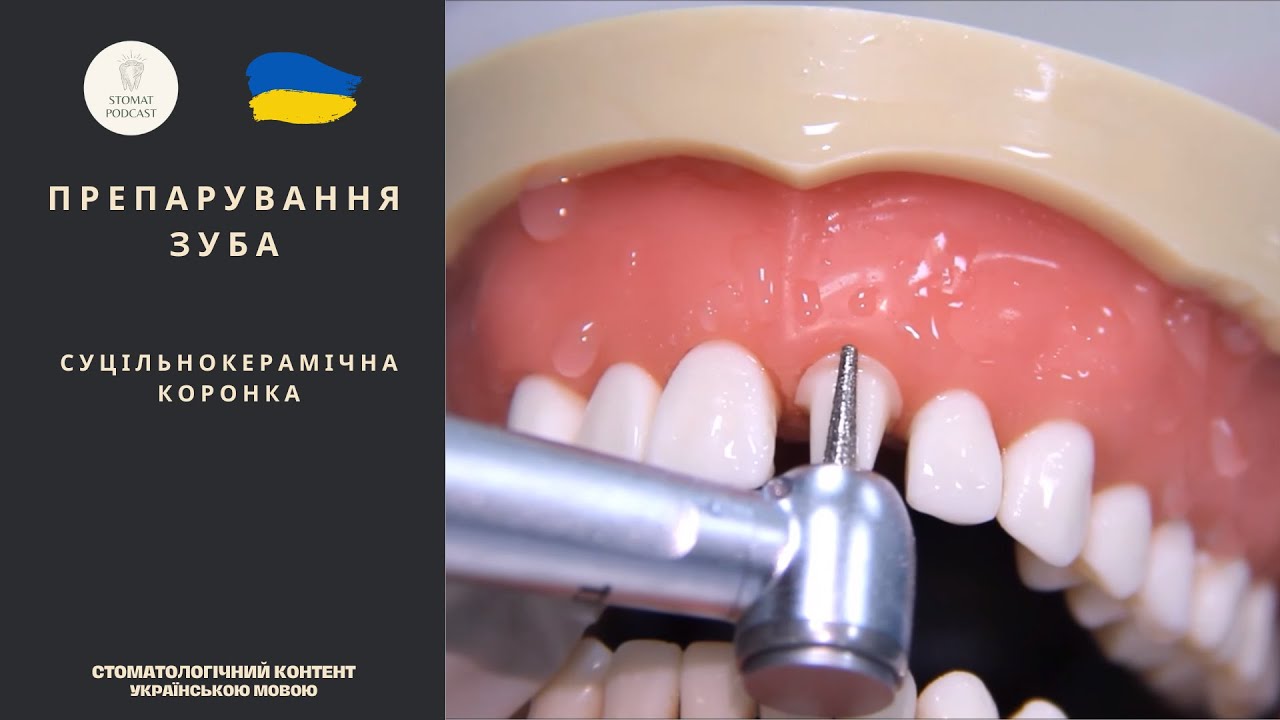 Препарування зуба під суцільнокерамічну коронку
