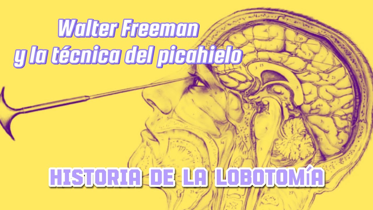 Episodio 46: Walter Freeman y la técnica del picahielo