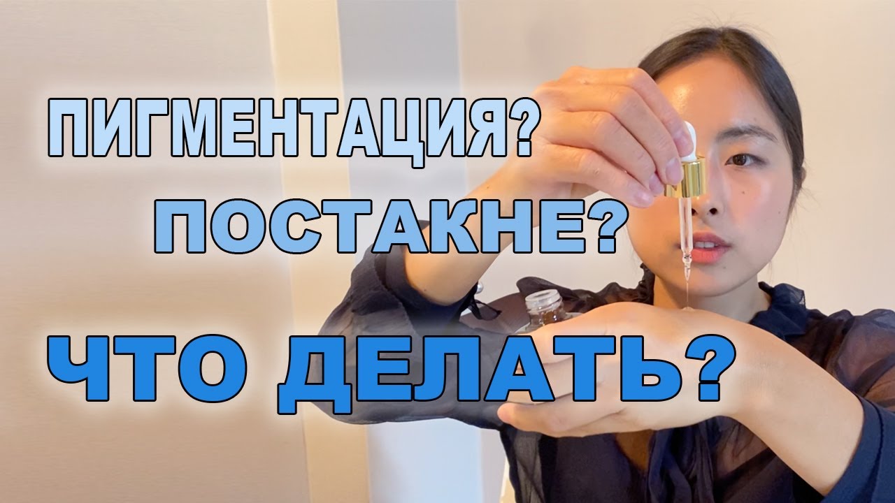 7 СРЕДСТВ ОТ ПИГМЕНТАЦИИ И ПОСТАКНЕ / ISNTREE, MISSHA, COSRX, FAU