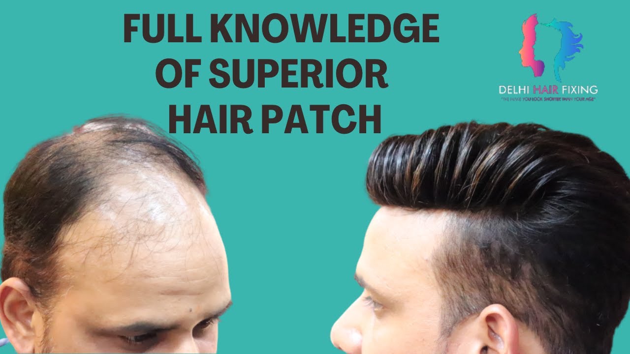 Superior hair patch system in Delhi! This patch Services Available in! Delhi Hair Fixing