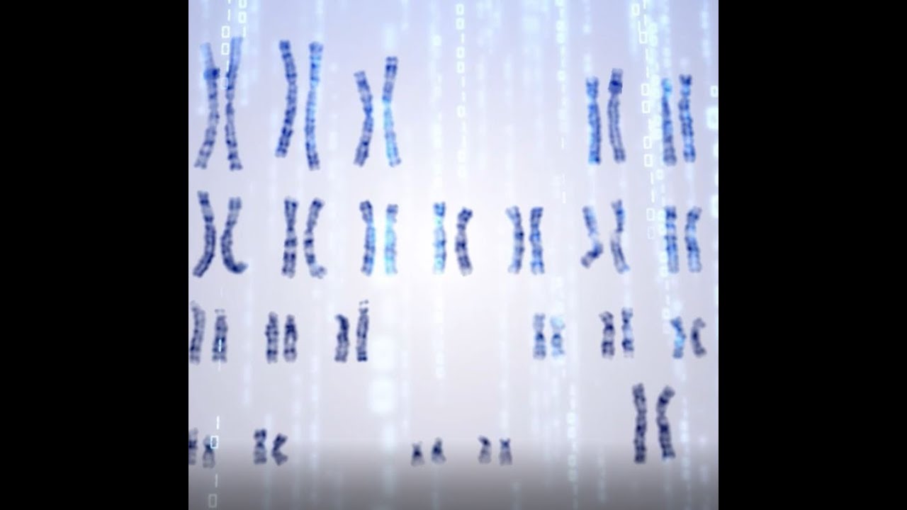 AI Based Karyotyping on Bone Marrow Samples
