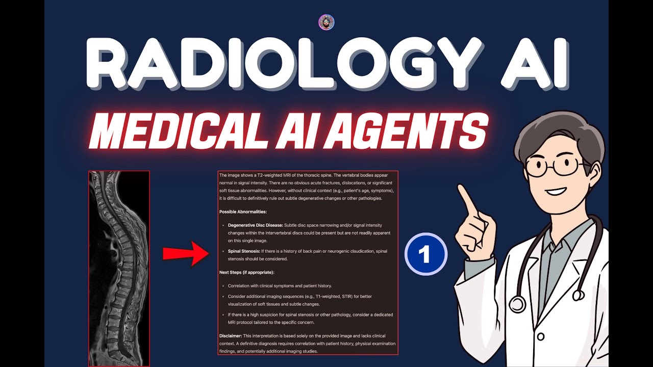 Radiology AI Project: Part 1 (Setup Open Source LLM)