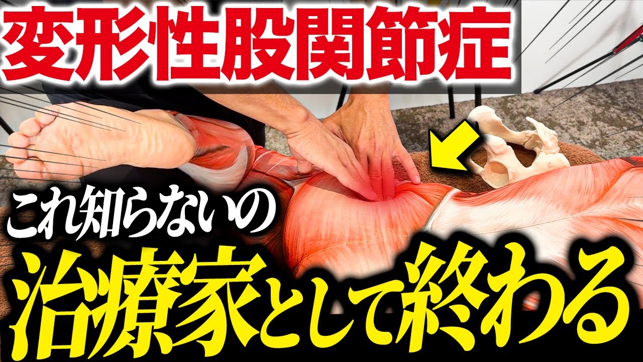 【全治療家必見】ここだけの「変形性股関節症」の超効果的な神ワザテクニックを伝授します！！