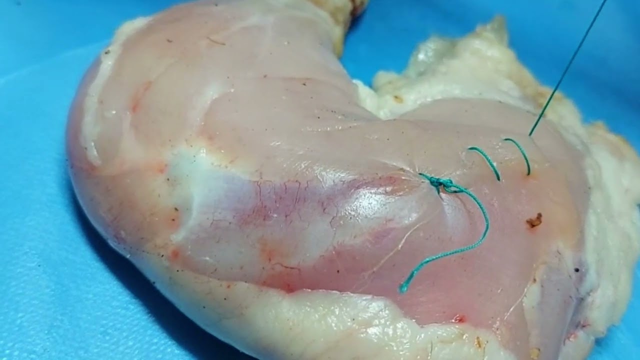 #Surjet simple : Techenique de suture