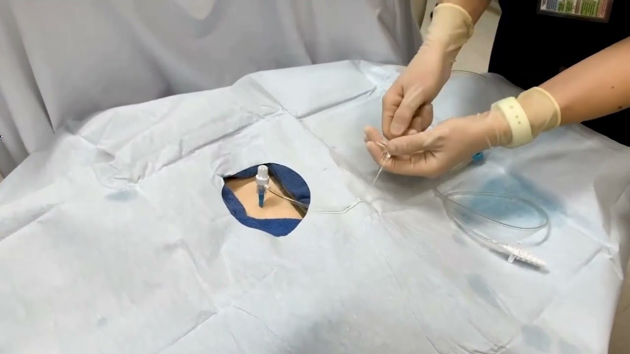 How to Perform a Thoracentesis using the Safe-T-Centesis™ kit